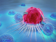 پاکستان میں 20 فیصد سرطان کے مریض خون کے کینسر میں مبتلا ہیں ماہر