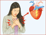 خواتین اور دل کے عوارض