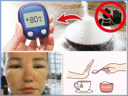 انسان کی من بھاتی غذا چینی زیادہ کھانے پر خبردار کرتی 8 علامتیں