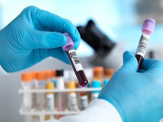 درجن بھر کینسر کی اقسام کی نشان دہی کرنے والا خون کا نیا ٹیسٹ