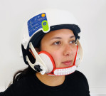 کینسر علاج میں جھڑتے بالوں کو روکنے کیلئے جدید ہیلمٹ متعارف