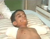 بچے کے بازو کاٹنے کی سفاکانہ واردات اور حکمران  