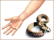 سانپ ڈس جائے تو… 