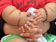 پاکستان میں پہلی بار بچے کا موٹاپا کم کرنے کیلیے کامیاب سرجری 