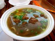 کولیسٹرول کی زیادتی۔۔۔ بلڈ پریشر اور امراضِ قلب کا باعث بن سکتی ہے  