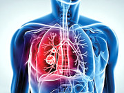 پھیپھڑوں کا سرطان ظاہر ہونے میں 20 سال لگا دیتا ہے 