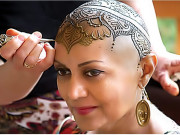 بالوں سے محروم خواتین کے لیے انوکھا حل 