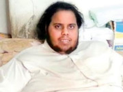 28سالہ سعودی نوجوان کا وزن 400کلوگرام تک پہنچ گیا 