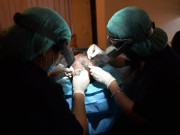 پاکستانیوں میں ہیئر ٹرانسپلانٹ کا رجحان تیزی سے بڑھ رہا ہے  سروے