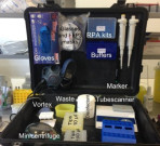 ایبولا وائرس کی تشخیص صرف 15 منٹ میں سوٹ کیس لیبارٹری سے ممکن