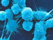 ’’ایبولا‘‘ 