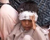 بات کچھ اِدھر اُدھر کی  بیماری یا جادوٹونا