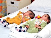 پیدائشی طور پر جڑی بچیوں کو الگ کرنے کا آپریشن کامیاب  