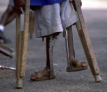 پشاور فاٹا اور بلوچستان سے پولیو  کے 4 نئے کیسز سامنے آگئے