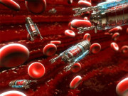 انسانی علاج کے لیے رگوں میں دوڑنے والے جدید ترین روبوٹس تیار