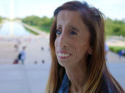 بدصورت ترین کہلائی جانے والی خاتون نے اپنے بلند عزائم سے خود کو منوا لیا