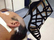 لڑائی کے دوران بیوی نے شوہر کو سینڈل ایسی ماری جو سر میں ہی جا گھسی