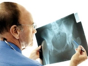 جوڑوں کا درد علامات اور اسباب