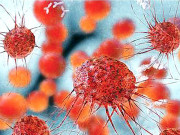 ٹانگوں کی ایک بیماری جو جان لیوا ثابت ہوسکتی ہے