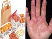 الرجی چند علامات اور وجوہات