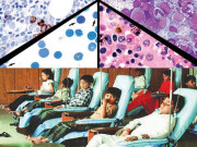 تھیلیسیمیا…مہلک مرض سے آئندہ نسلوں کو کیسے محفوظ رکھا جائے