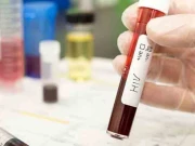 سندھ میں ایڈز کے 894  نئے کیسز رپورٹ