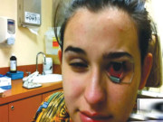 آنکھ کے علاج کا انوکھا طریقہ