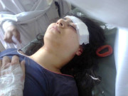 ملالہ کے علاج کیلئے ٹیم تشکیل حالت تسلی بخش قرار