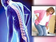 کمردرد کی ممکنہ وجوہات اورعلاج