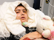 لندن ملالہ کی حالت بہتر آنکھیں کھول لیں سہارا لیکر کھڑی ہونے کے قابل 