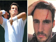 اسٹیون فن کو راہ چلتے موبائل استعمال کرنا مہنگا پڑگیا سائن بورڈ سے ٹکرا کرماتھا زخمی