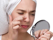 مسئلہ بلیک ہیڈز کا۔۔۔