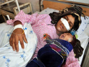 افغانستان میں شوہرنے بیوی کی ناک کاٹ ڈالی