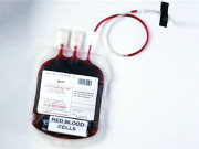 جینوم ٹیکنالوجی کی مدد سے تھیلیسیما کا علاج ممکن ہوگیا