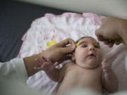 زیکا وائرس احتیاط کیجیے کہ احتیاط پچھتاوے سے بہتر ہے