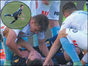 دنیائے فٹبال کی بدترین انجری ازخود گرجانے پر کیوی پلیئر اسٹروم کو3 سنگین چوٹیں