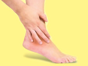 ٹخنے کی موچ  