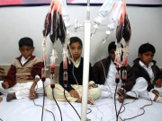 تھیلیسیمیا میں مبتلا بچوں کی تعداد میں اضافہ خون کی قلت 