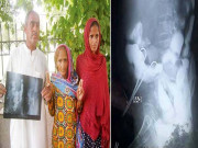 لاڑکانہ میں ڈاکٹرمریضہ کے پیٹ میں قینچی بھول گیا حالت غیرہوگئی