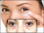 آنکھوں کے گرد حلقے پڑ رہے ہیں ایک اہم مسئلہ وجوہات سے نجات تک