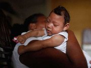 زیکا وائرس… چوکنا رہنے کی ضرورت