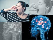 لمبی جماہی  تیز دماغ کی علامت بن گئی