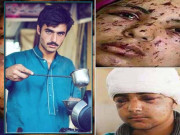 میری آنکھیں خریدو گے