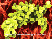 جلدی بیماریوں اور زخم میں پیچیدگی پیدا کرنے والے43اقسام کے جراثیم دریافت