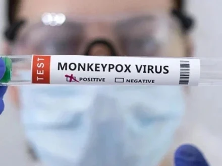 خیرپور میں بچوں میں منکی پاکس وبا کی تصدیق کردی گئی