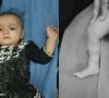 کراچی میں 6 ماہ کی شیر خوار بچی اندھی گولی لگنے سے زخمی