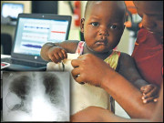 اسمارٹ جیکٹ اور موبائل ایپ سے نمونیے کی فوری شناخت ممکن