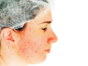 جلد کے لیے نقصان دہ روزمرہ کی غلطیاں