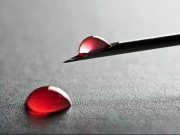 ٹنڈو الٰہیارانتظامیہ کی بے حسی کے باعث  ہیپاٹائٹس پھیلنے لگا