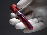 خون کا عطیہ دینے سے روزہ نہیں ٹوٹتا علما